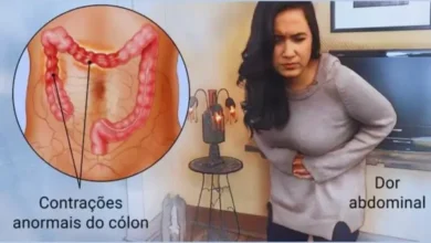 Síndrome-do-Intestino-Irritável
